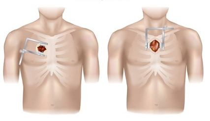 Surgical Access Final